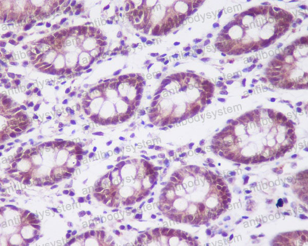 Валидация AntibodySystem RHF62501