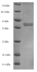 SDS-PAGE