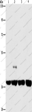 Вестерн-блоттинг, SERPINA9, клетки 293T, 231, U937 и Raji
