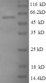 SDS-PAGE