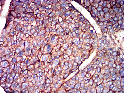 Валидация AntibodySystem RHE14006 (1982)