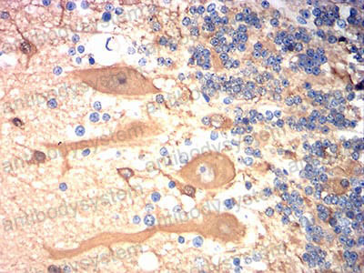 Валидация AntibodySystem RHG56705