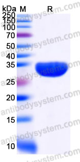 YHH05401, SDS-PAGE