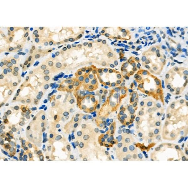 Валидация Affinity DF3886 - 15047