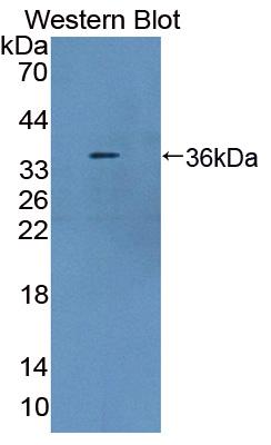 57652