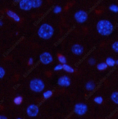 Иммунофлуоресценция, Phospho-p38 (Thr180/Tyr182), ткань печени мыши