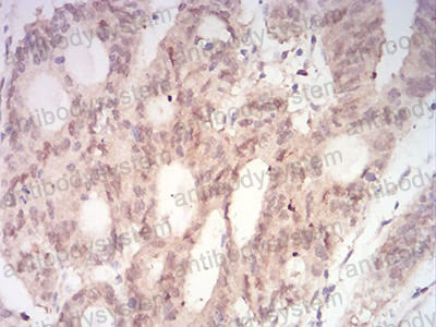 Валидация AntibodySystem RHE48804