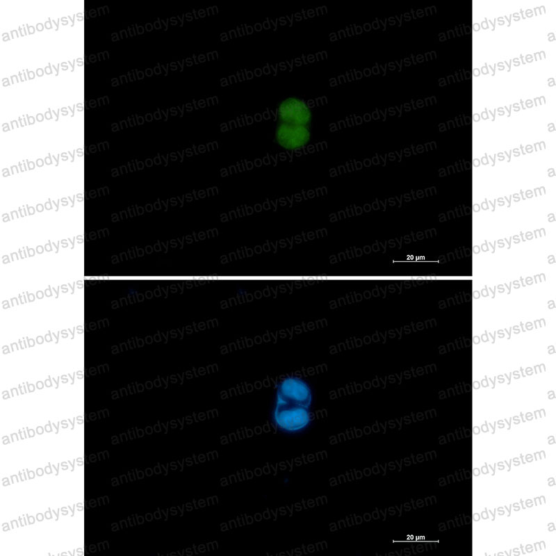 Валидация IF - AntibodySystem RHE48801