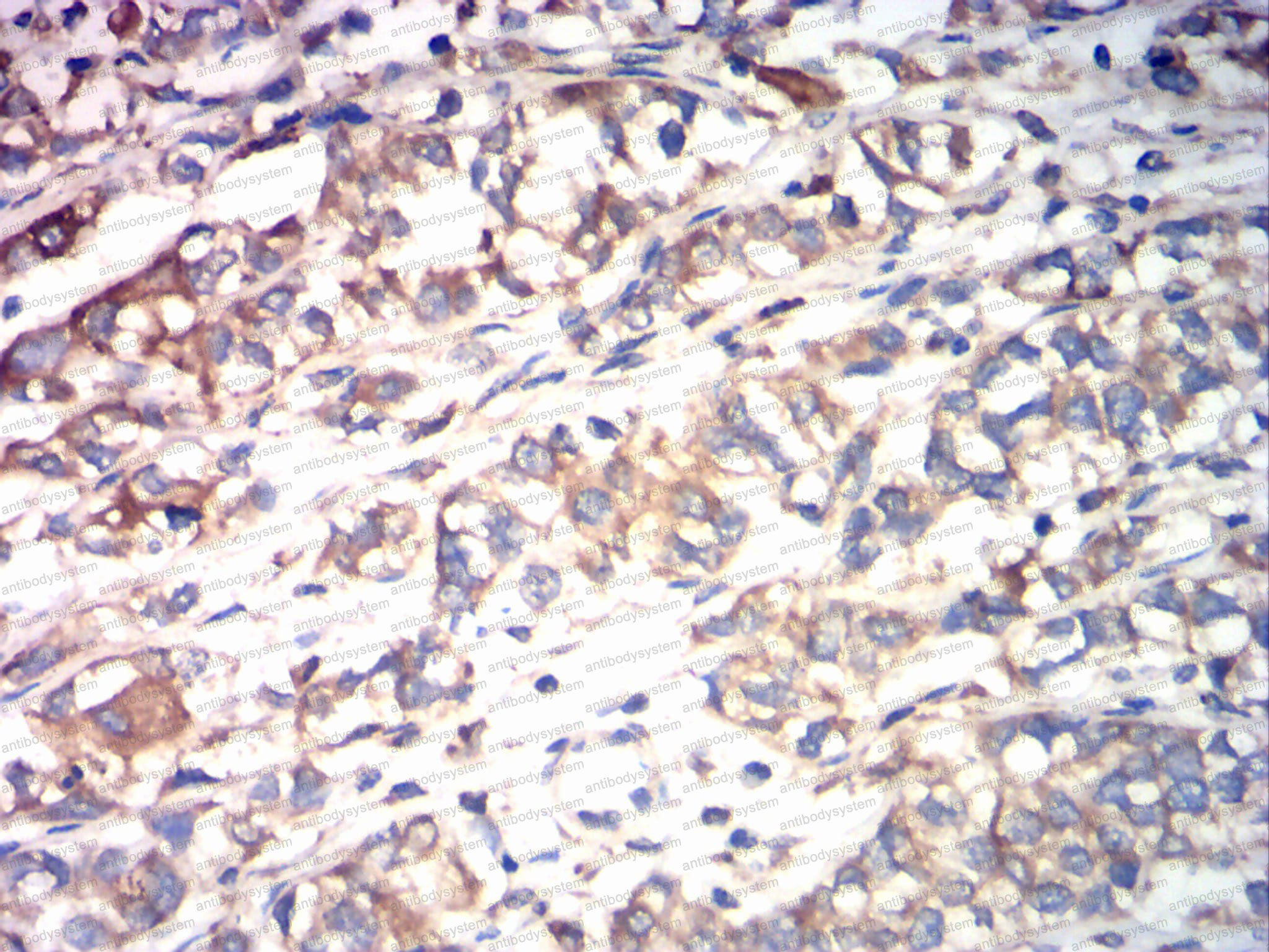 Валидация AntibodySystem RHD75203