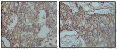 Валидация AntibodySystem RHD14802 (1355)