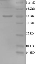 SDS-PAGE