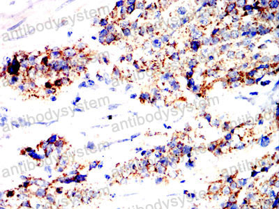 Валидация AntibodySystem RHA21802 (70)