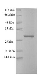 SDS-PAGE