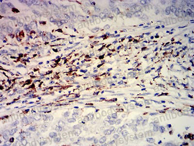 Валидация AntibodySystem RHJ70110 (3522)