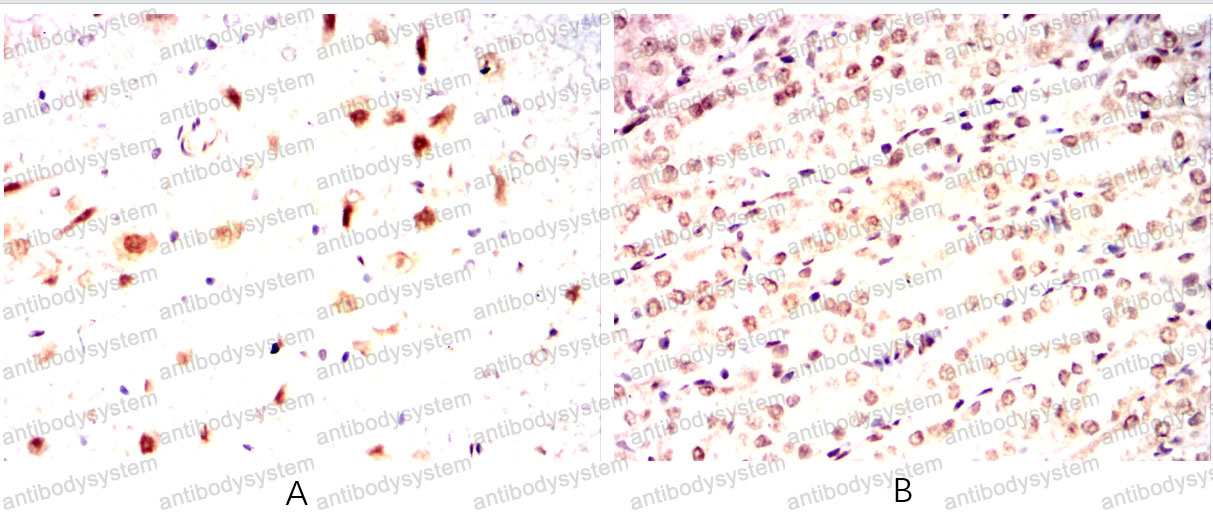 Валидация AntibodySystem RHK50101