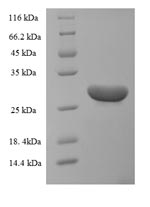 SDS-PAGE