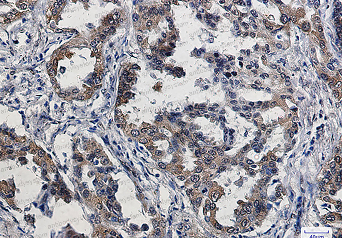 Валидация AntibodySystem RHC20902