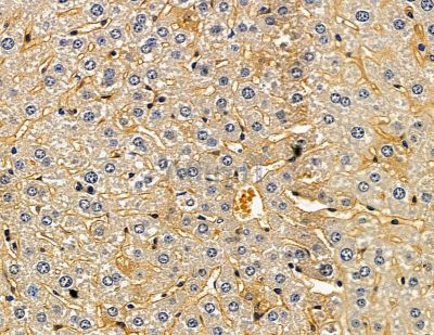 Валидация Affinity DF13915 - 9651