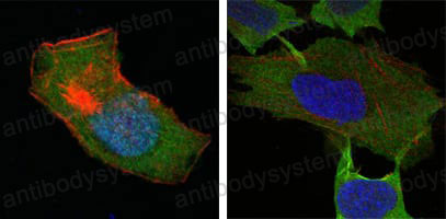 Валидация IF - AntibodySystem RHC39302 (406)