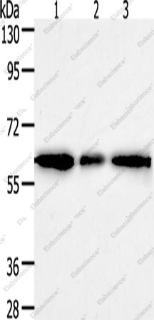 Вестерн-блоттинг, AKR1A1, ткань рака печени человека и клетки HeLa, 293T