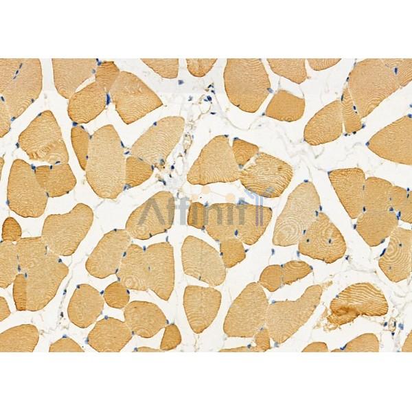 Валидация Affinity DF7293 - 18973