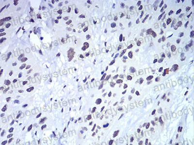 Валидация AntibodySystem RHE45604 (2167)