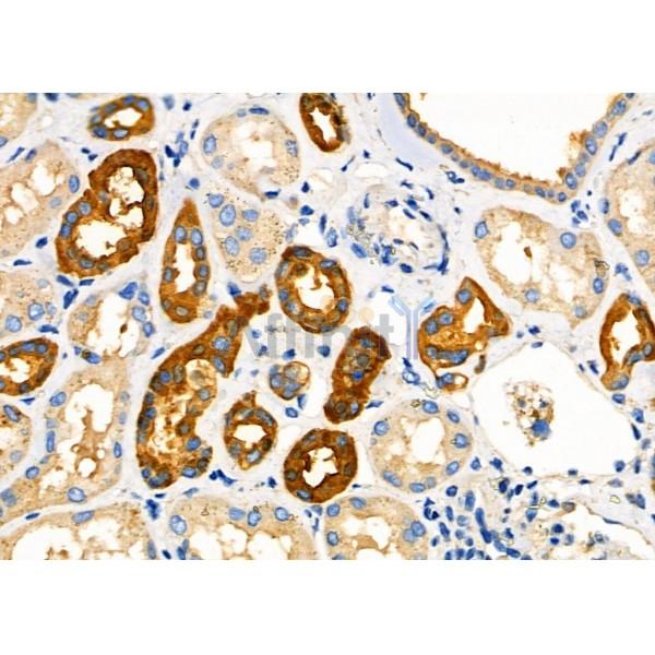 Валидация Affinity DF7966 - 19795