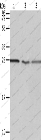 Вестерн-блоттинг, PSMD9, клетки Jurkat, A549 и ткань почки плода человека