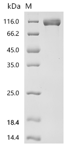 SDS-PAGE