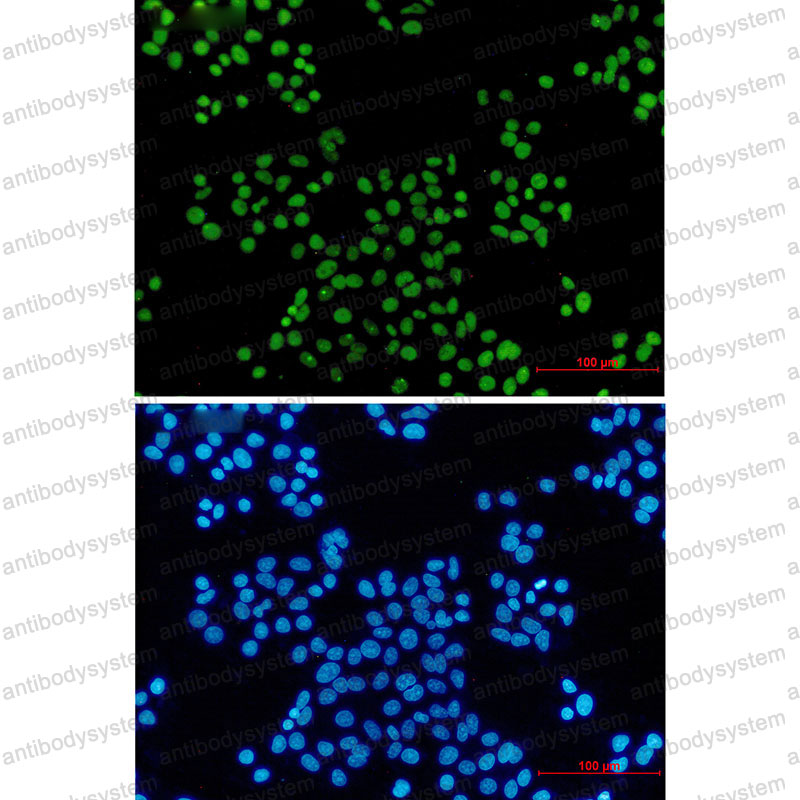Валидация IF - AntibodySystem RHE68801