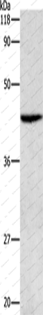 Вестерн-блоттинг, ATG4B, клетки HeLa
