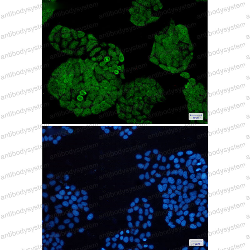 Валидация IF - AntibodySystem RHJ89201