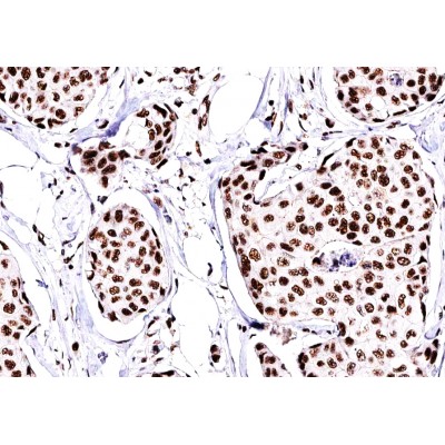 Валидация Affinity AF6089 - 3296