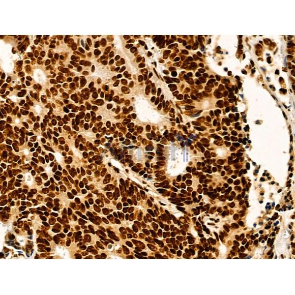 Валидация Affinity DF13078 - 7949