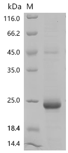 SDS-PAGE
