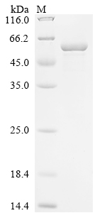 SDS-PAGE