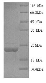 SDS-PAGE