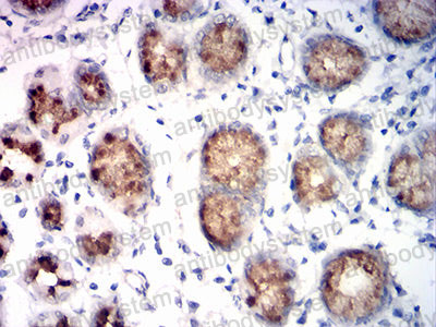 Валидация AntibodySystem RHF78601 (2670)