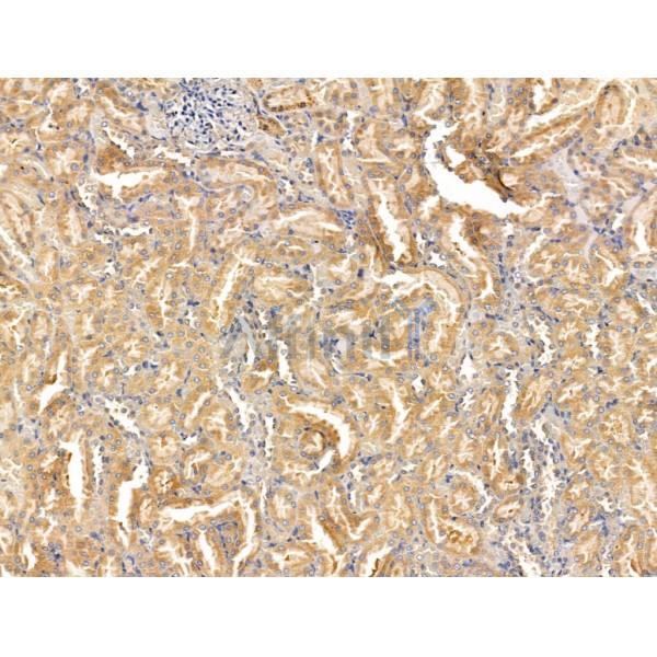 Валидация Affinity DF13599 - 9090