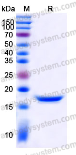 YHJ69502, SDS-PAGE