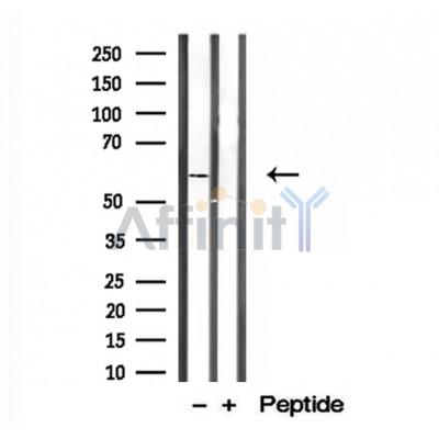 Валидация Affinity DF12131 - 6292