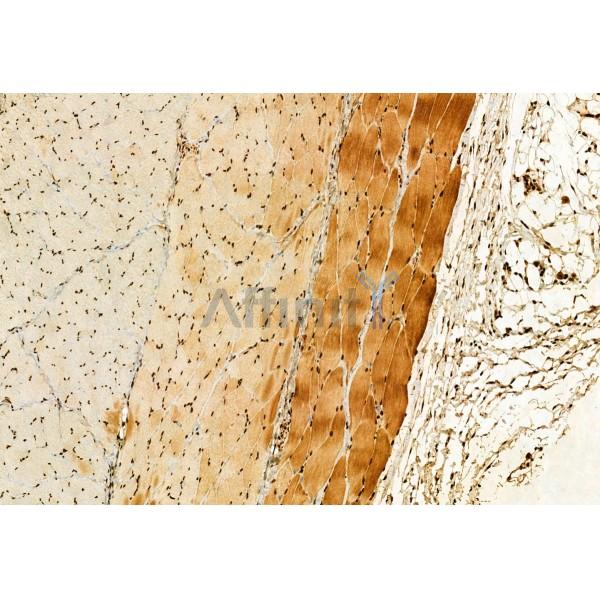 Валидация Affinity DF12116 - 6256