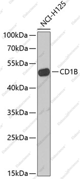Вестерн-блоттинг, CD1B, клетки NCI-H125
