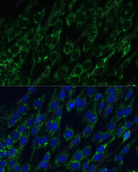 Иммунофлуоресценция, IDH2, клетки C6