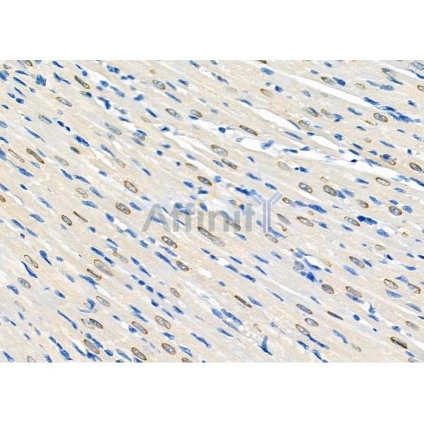 Валидация Affinity DF8887 - 20995