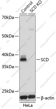 Вестерн-блоттинг, SCD, клетки HeLa