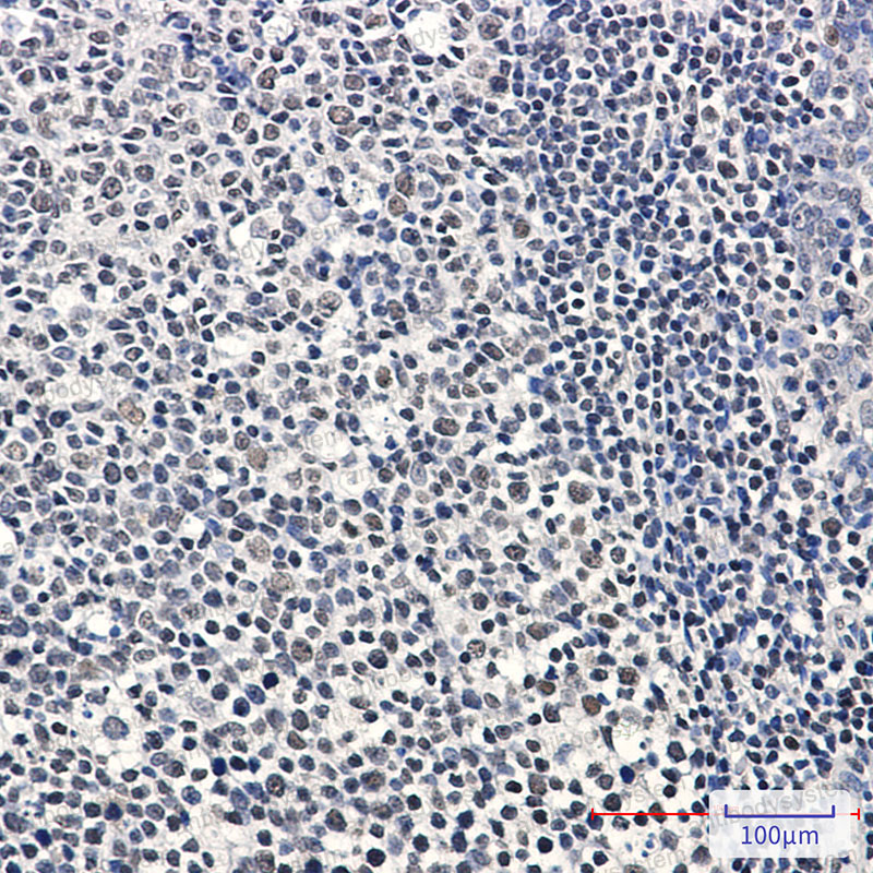 Валидация AntibodySystem RHN53001