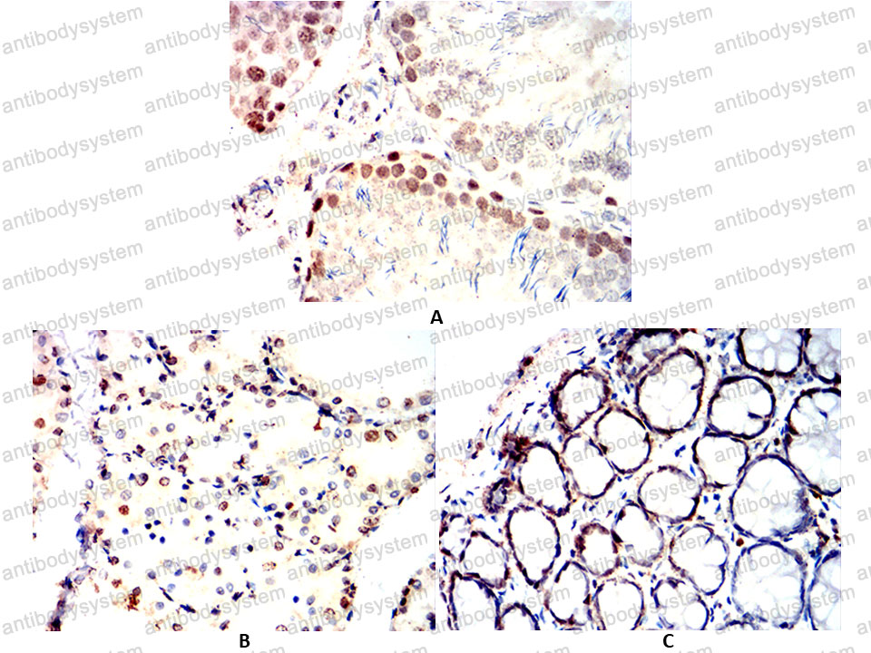 Валидация AntibodySystem RHC91302 (1174)