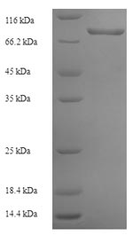 SDS-PAGE