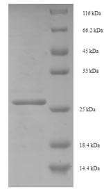 SDS-PAGE